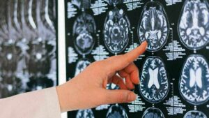 Home 29 1 ai brain scan tool predicts how fast you are aging