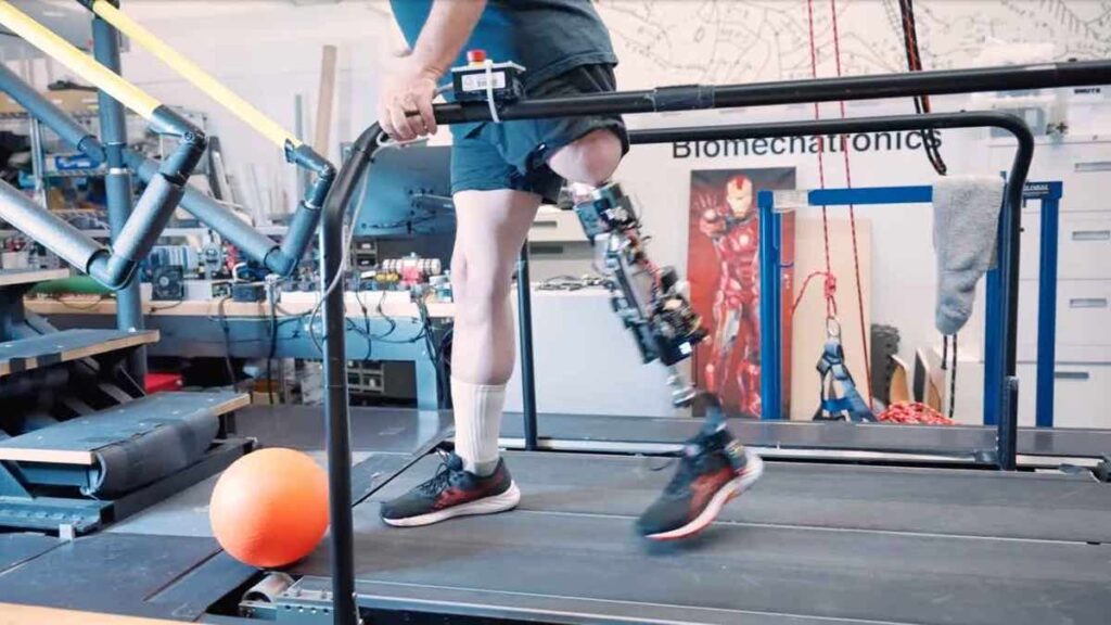 1 bionic knee helps amputees walk naturally again
