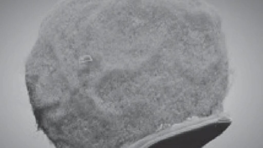 Tiny chips hitch a ride on immune cells to sites of inflammation 2 cell chip 1152x648 1